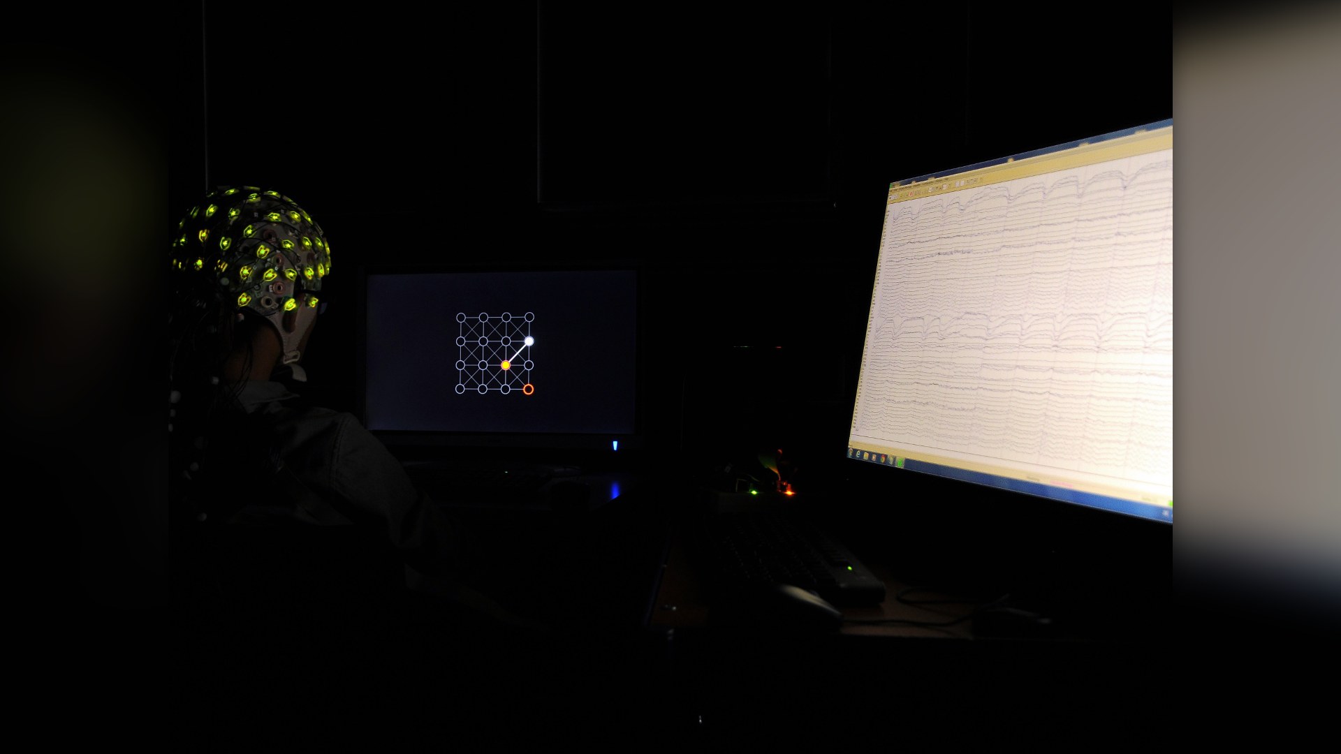 #12. Neuralink Brain Interfaces: High-Bandwidth Neurotech