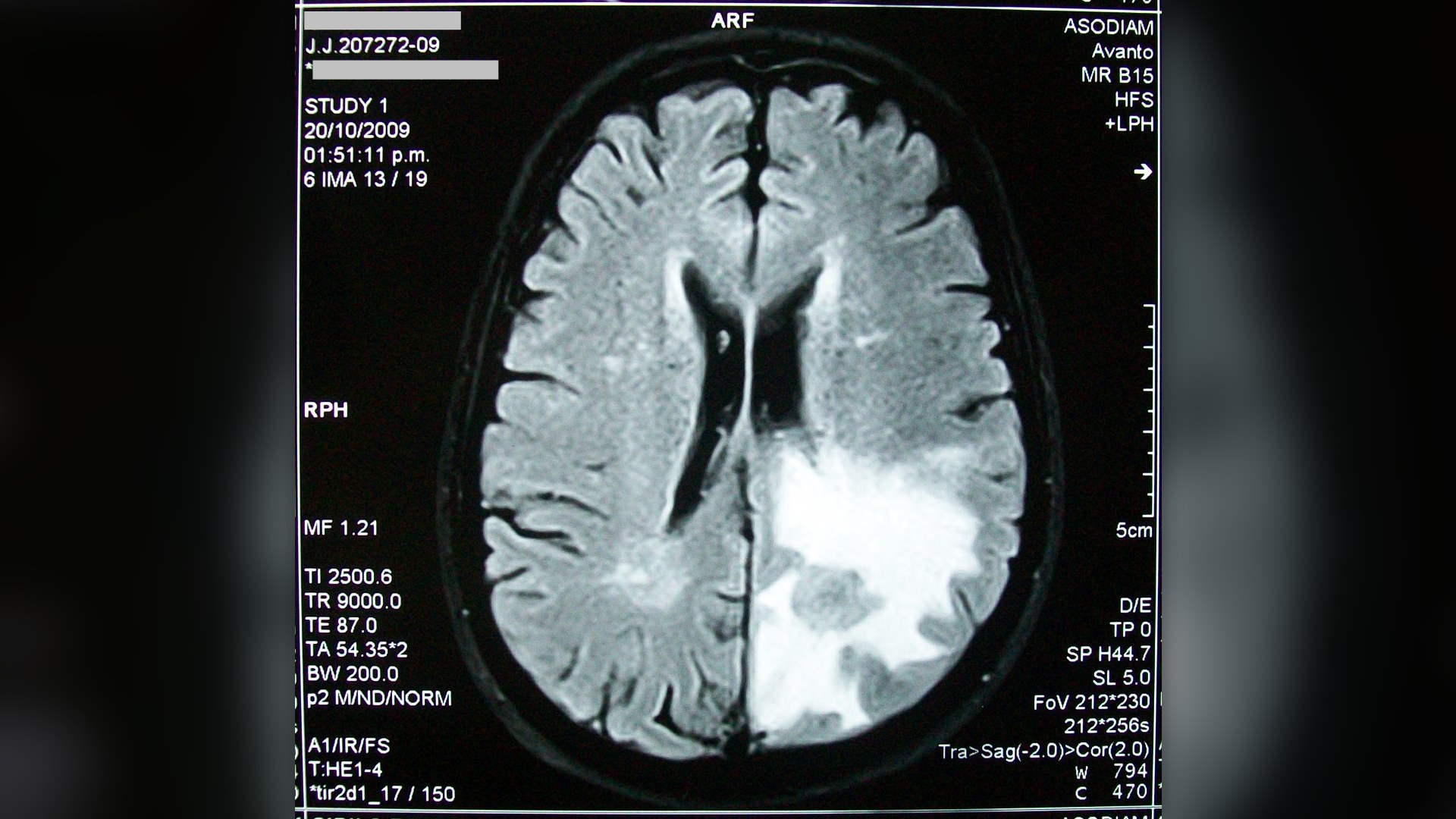 6. Sub-Millimeter Radiology Precision