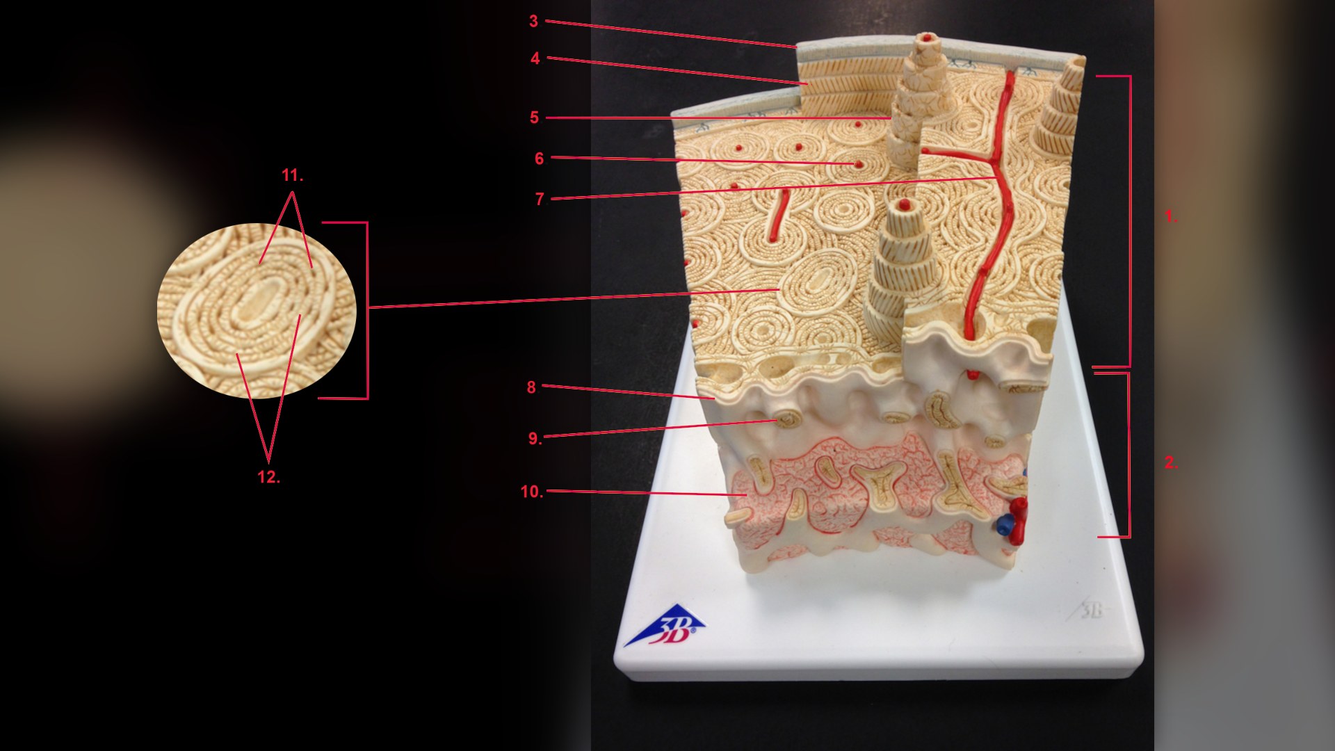 11. Stronger Bone Matrix