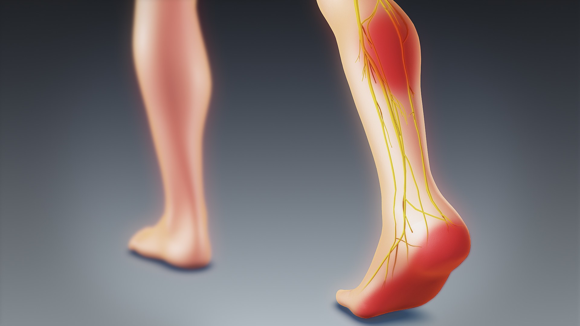 Medical illustration of sciatic nerve pathway down the lower back and leg