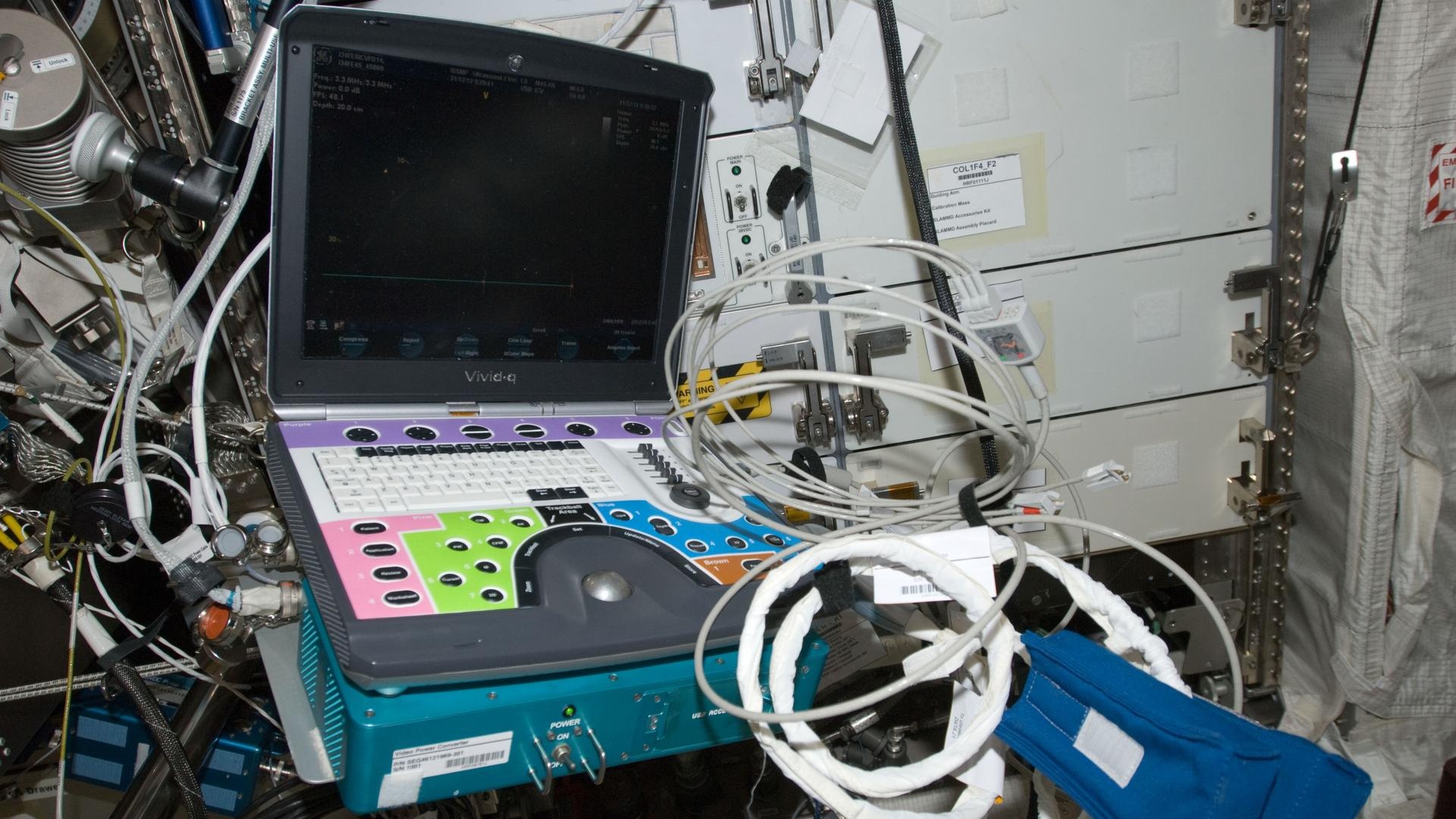 Astronaut undergoing an in-flight cardiovascular ultrasound examination aboard the ISS