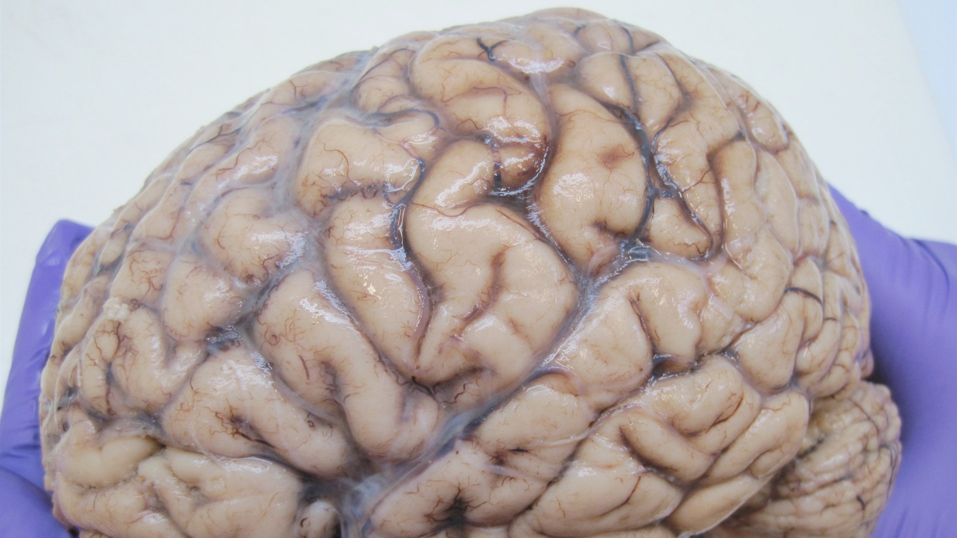 3. Your Brain Works Better