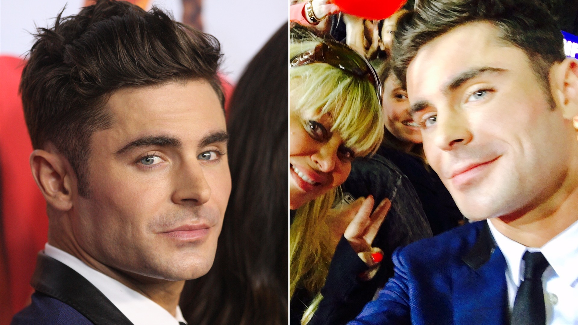 50/50 split comparison of Zac Efron before and after his jaw injury and reconstruction
