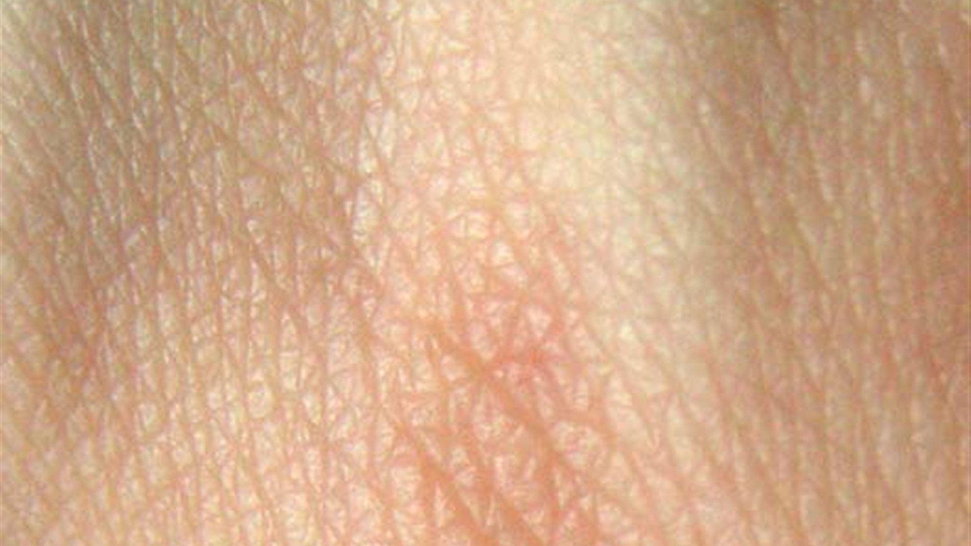 7. Your Skin And Hair Improve