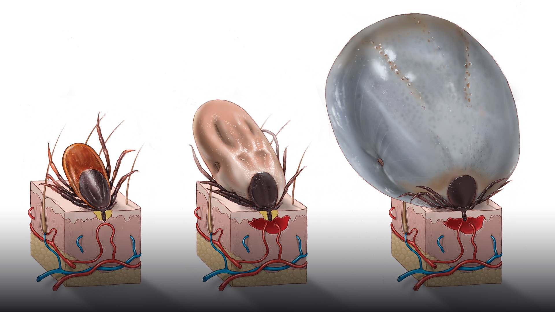 Extreme macro of an adult female deer tick showing its dark shield and specialized mouthparts.