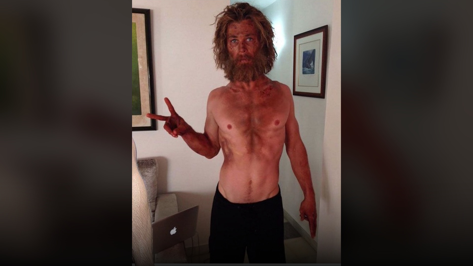 Chris Hemsworth appearing emaciated and sunburnt after extreme weight loss for In the Heart of the Sea.