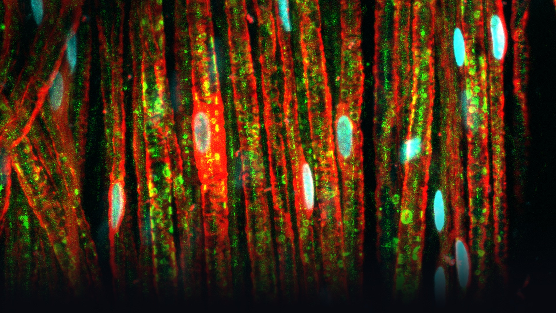 Immunofluorescence microscopy revealing complex neural axon networks and myelin sheaths.