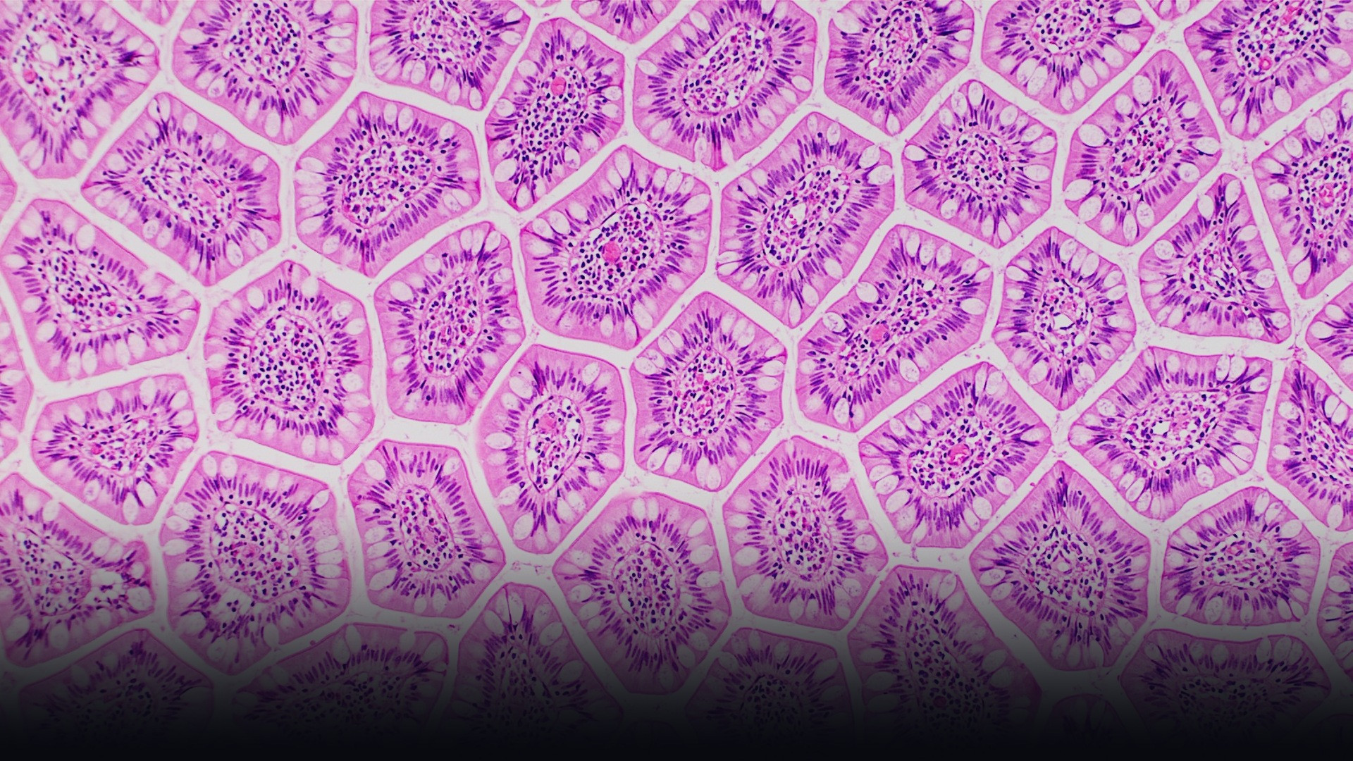 High-magnification histological section showing intestinal mucosal villi in the terminal ileum.